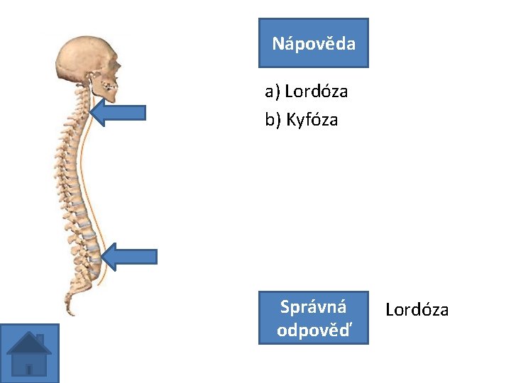 Nápověda a) Lordóza b) Kyfóza Správná odpověď Lordóza 