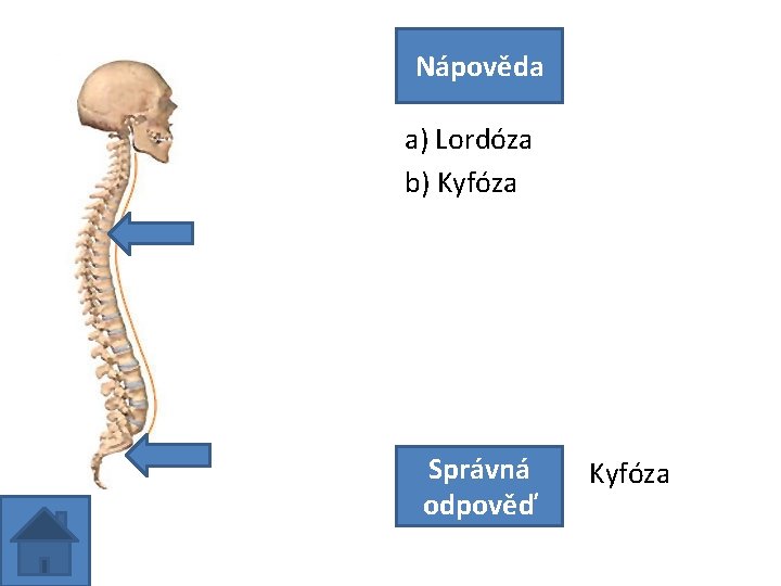 Nápověda a) Lordóza b) Kyfóza Správná odpověď Kyfóza 