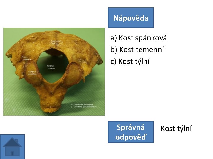 Nápověda a) Kost spánková b) Kost temenní c) Kost týlní Správná odpověď Kost týlní