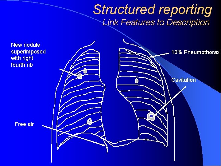 Structured reporting Link Features to Description New nodule superimposed with right fourth rib 10%