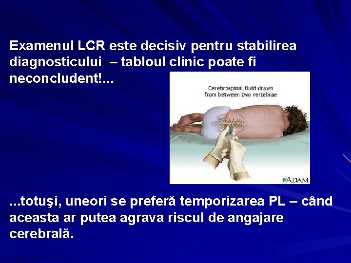 Examenul LCR este decisiv pentru stabilirea diagnosticului – tabloul clinic poate fi neconcludent!. .