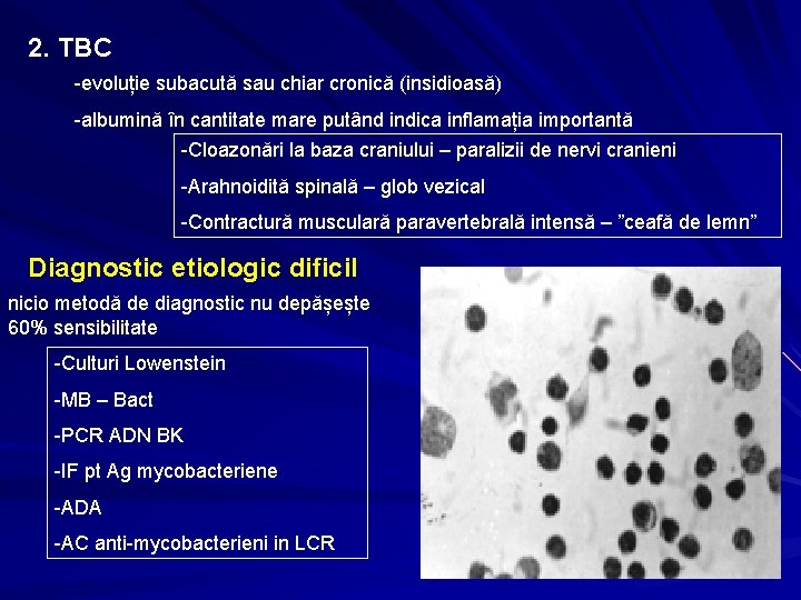 2. TBC -evoluție subacută sau chiar cronică (insidioasă) -albumină în cantitate mare putând indica