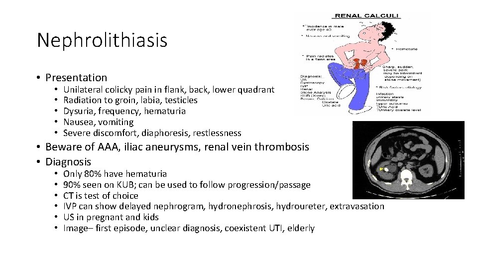 Nephrolithiasis • Presentation • • • Unilateral colicky pain in flank, back, lower quadrant