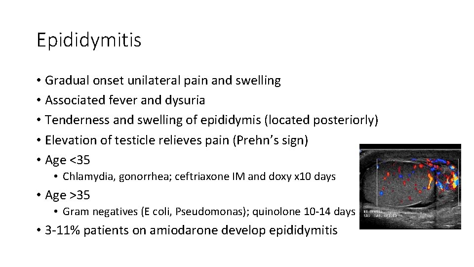 Epididymitis • Gradual onset unilateral pain and swelling • Associated fever and dysuria •