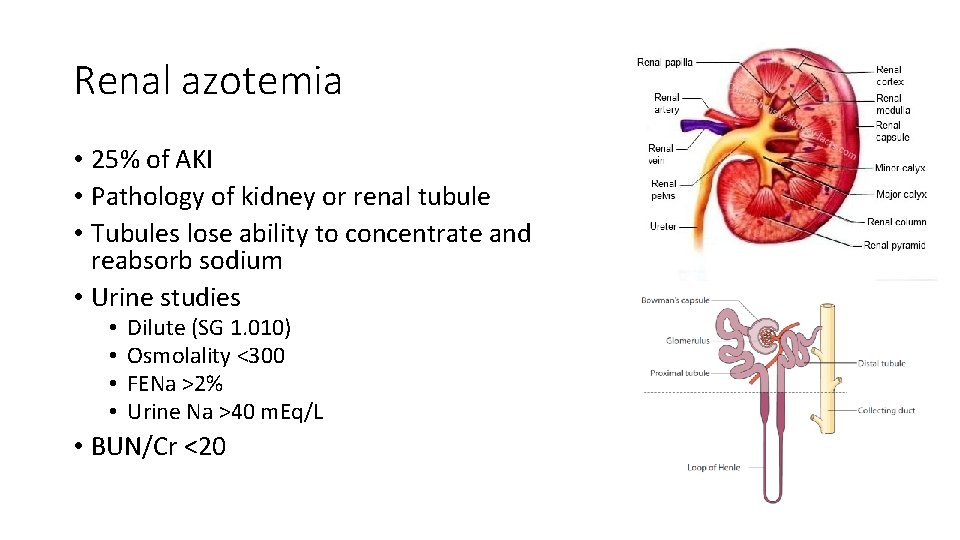 Renal azotemia • 25% of AKI • Pathology of kidney or renal tubule •