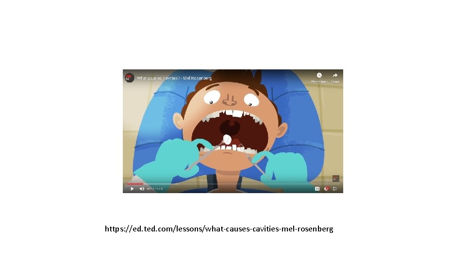 https: //ed. ted. com/lessons/what-causes-cavities-mel-rosenberg 