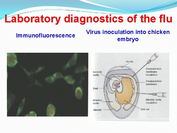 Laboratory diagnostics of the flu Immunofluorescence Virus inoculation into chicken embryo 