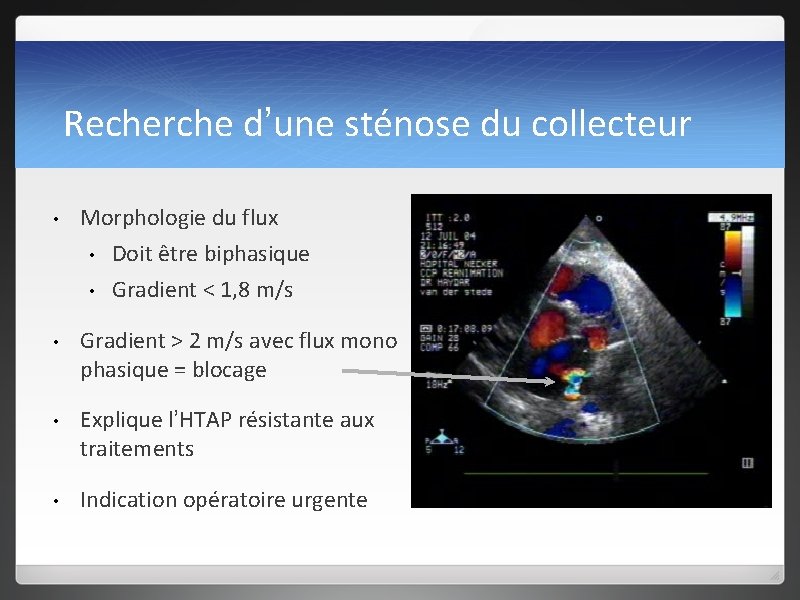 Recherche d’une sténose du collecteur • Morphologie du flux • Doit être biphasique •