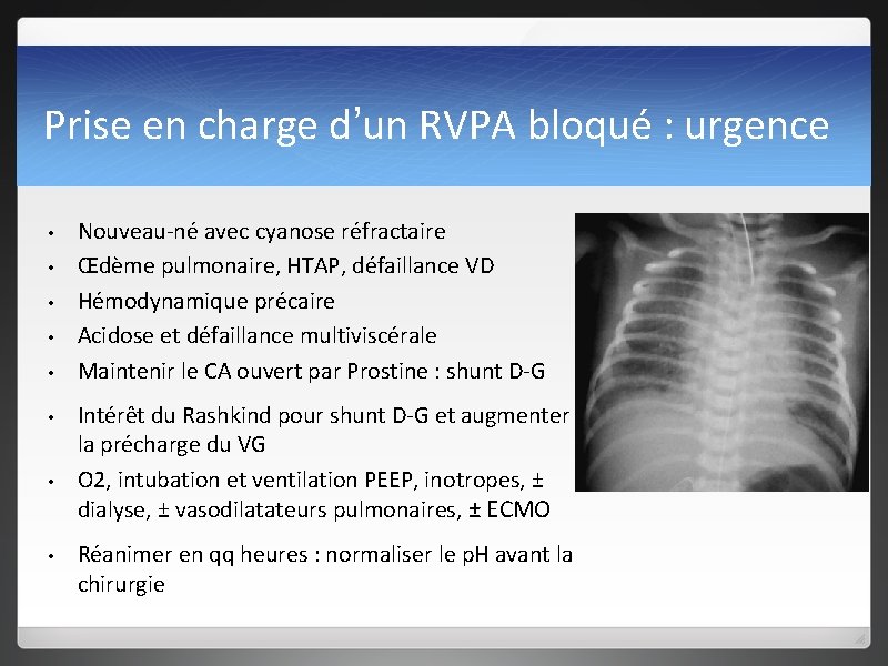 Prise en charge d’un RVPA bloqué : urgence • • Nouveau-né avec cyanose réfractaire