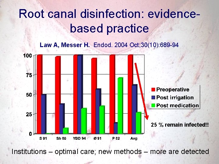 Root canal disinfection: evidencebased practice Law A, Messer H. Endod. 2004 Oct; 30(10): 689