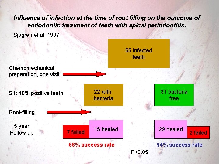 Influence of infection at the time of root filling on the outcome of endodontic