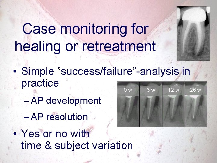 Case monitoring for healing or retreatment • Simple ”success/failure”-analysis in practice – AP development