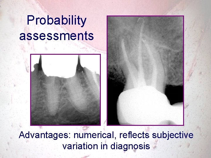 Probability assessments Advantages: numerical, reflects subjective variation in diagnosis 