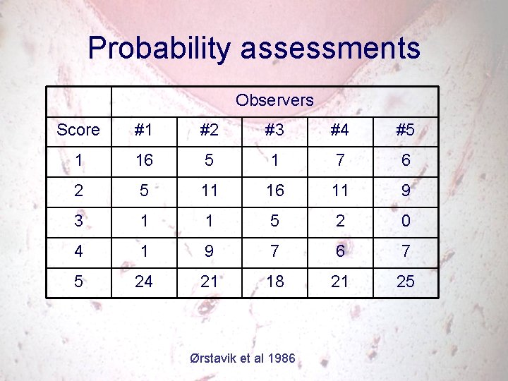 Probability assessments Observers Score #1 #2 #3 #4 #5 1 16 5 1 7