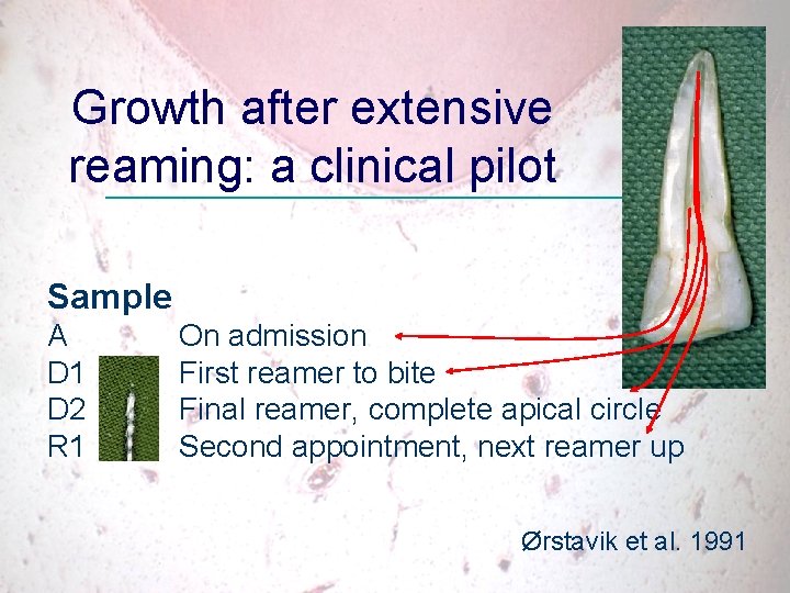 Growth after extensive reaming: a clinical pilot Sample A D 1 D 2 R