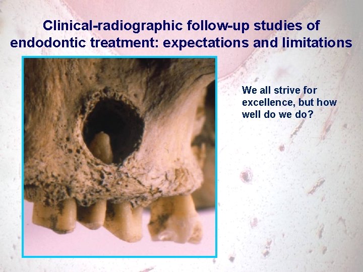 Clinical-radiographic follow-up studies of endodontic treatment: expectations and limitations We all strive for excellence,