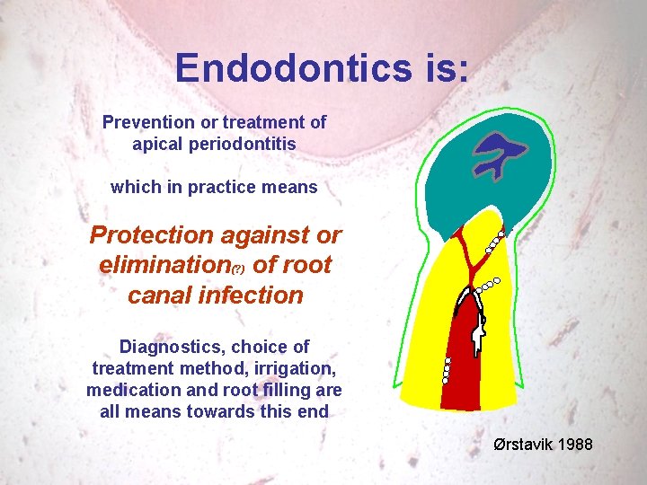 Endodontics is: Prevention or treatment of apical periodontitis which in practice means Protection against