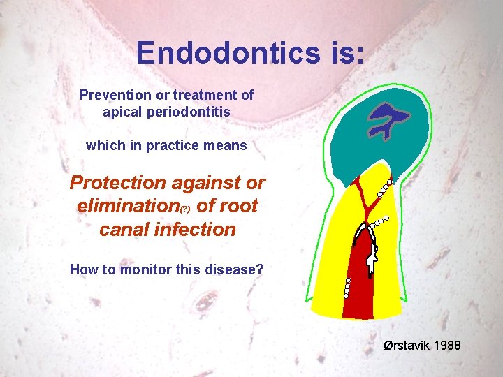 Endodontics is: Prevention or treatment of apical periodontitis which in practice means Protection against