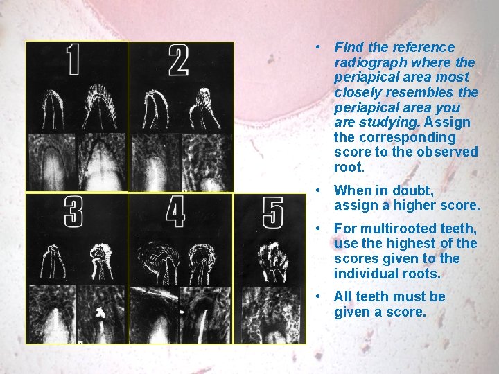  • Find the reference radiograph where the periapical area most closely resembles the