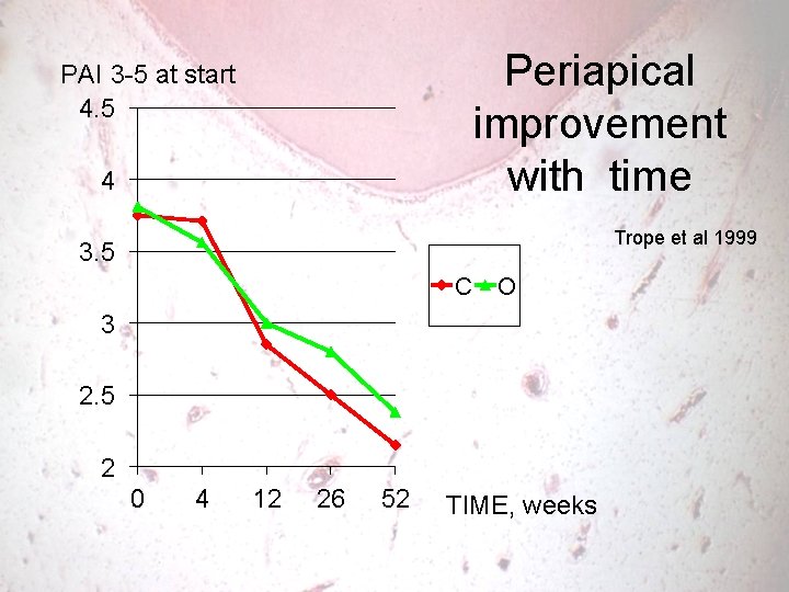 Periapical improvement with time PAI 3 -5 at start 4. 5 4 Trope et