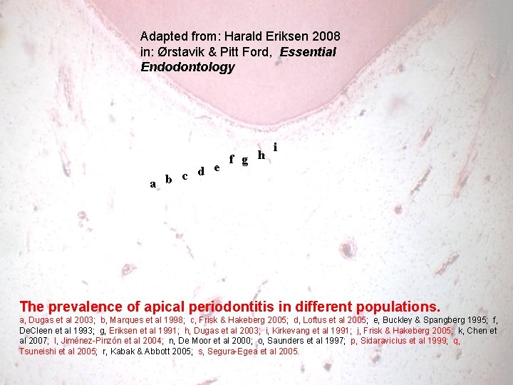 Adapted from: Harald Eriksen 2008 in: Ørstavik & Pitt Ford, Essential Endodontology d e