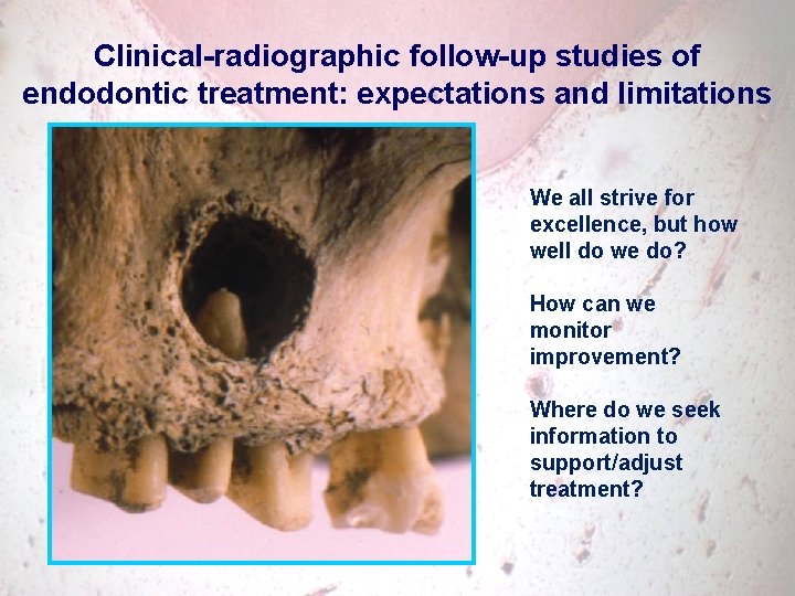Clinical-radiographic follow-up studies of endodontic treatment: expectations and limitations We all strive for excellence,