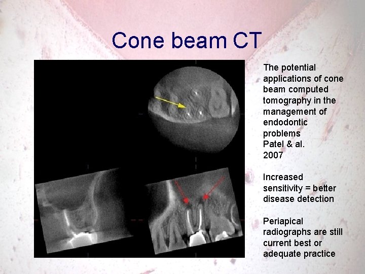 Cone beam CT The potential applications of cone beam computed tomography in the management