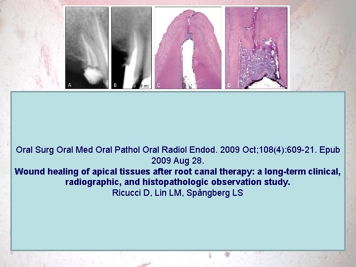 Oral Surg Oral Med Oral Pathol Oral Radiol Endod. 2009 Oct; 108(4): 609 -21.