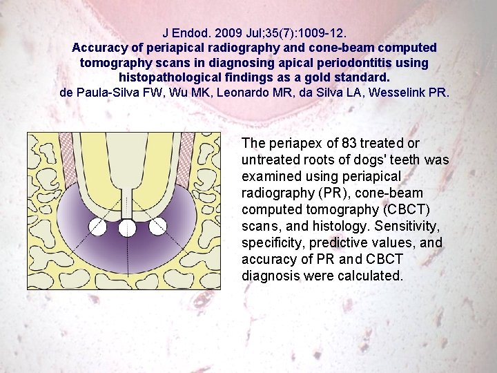 J Endod. 2009 Jul; 35(7): 1009 -12. Accuracy of periapical radiography and cone-beam computed