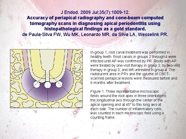 J Endod. 2009 Jul; 35(7): 1009 -12. Accuracy of periapical radiography and cone-beam computed