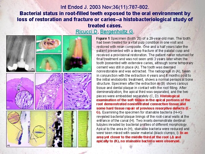 Int Endod J. 2003 Nov; 36(11): 787 -802. Bacterial status in root-filled teeth exposed