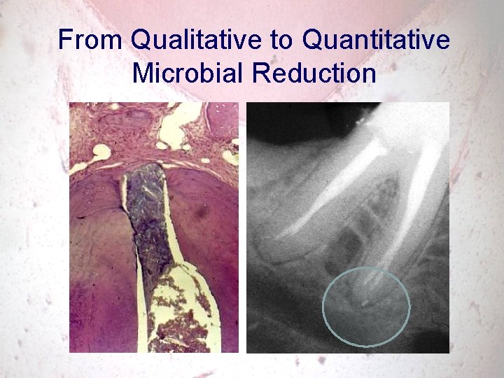 From Qualitative to Quantitative Microbial Reduction 