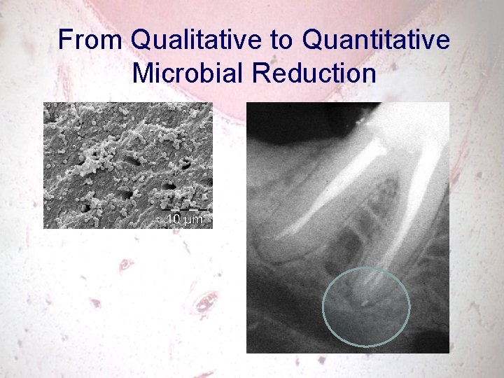 From Qualitative to Quantitative Microbial Reduction 