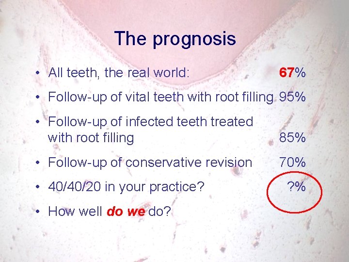 The prognosis • All teeth, the real world: 67% • Follow-up of vital teeth