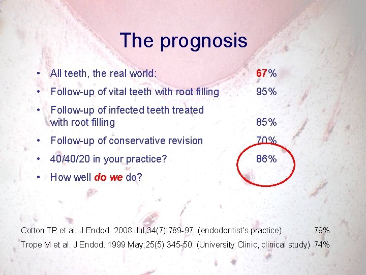 The prognosis • All teeth, the real world: 67% • Follow-up of vital teeth