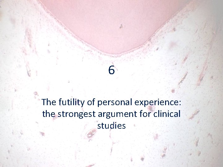 6 The futility of personal experience: the strongest argument for clinical studies 