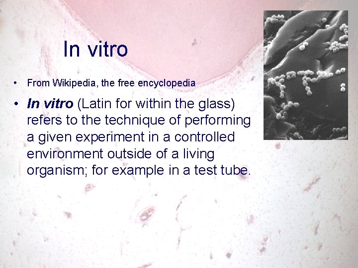 In vitro • From Wikipedia, the free encyclopedia • In vitro (Latin for within