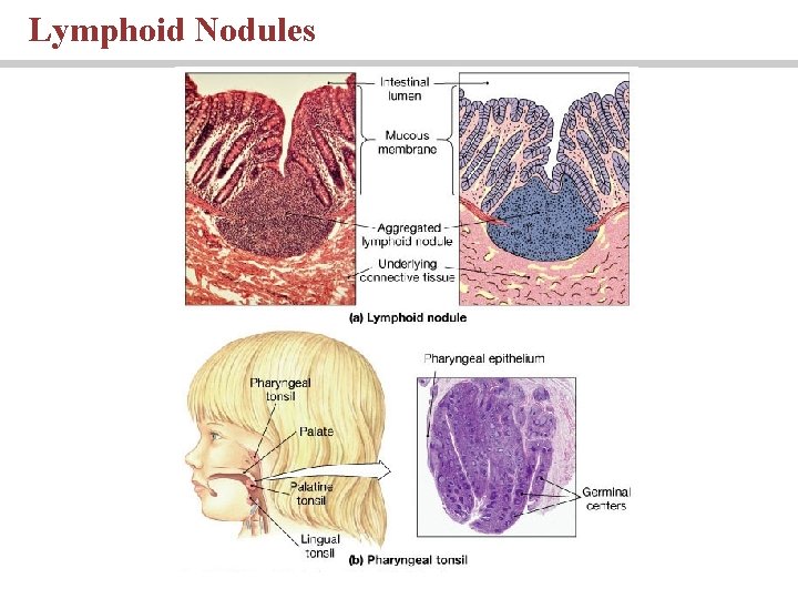 Lymphoid Nodules Lymphoid Nodules