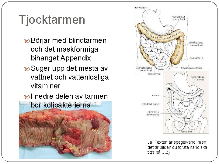 Tjocktarmen Börjar med blindtarmen och det maskformiga bihanget Appendix Suger upp det mesta av