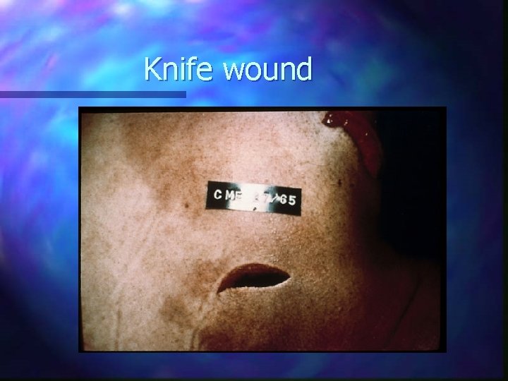 Knife wound 