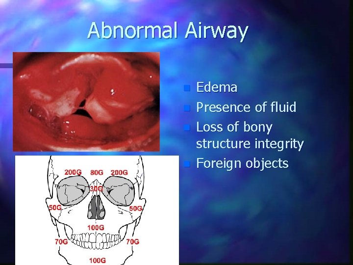 Abnormal Airway n n Edema Presence of fluid Loss of bony structure integrity Foreign