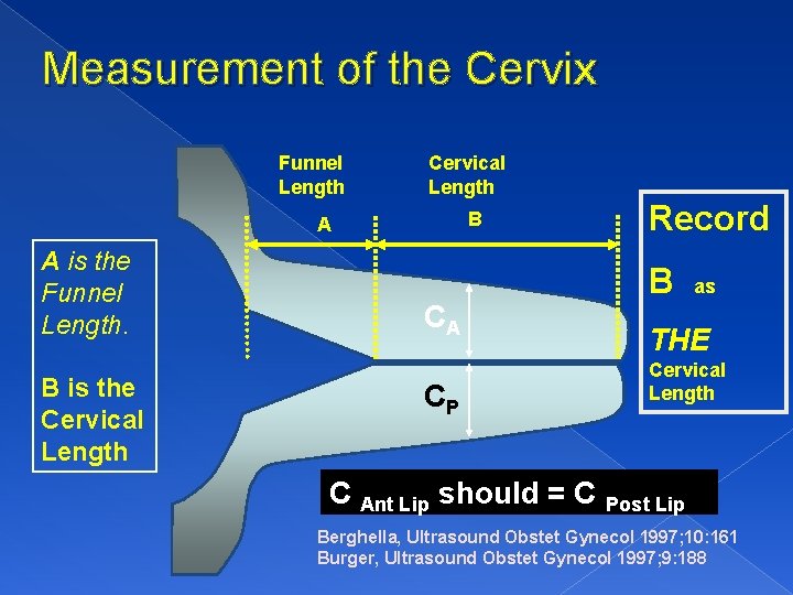 Measurement of the Cervix Funnel Length Cervical Length B A A is the Funnel