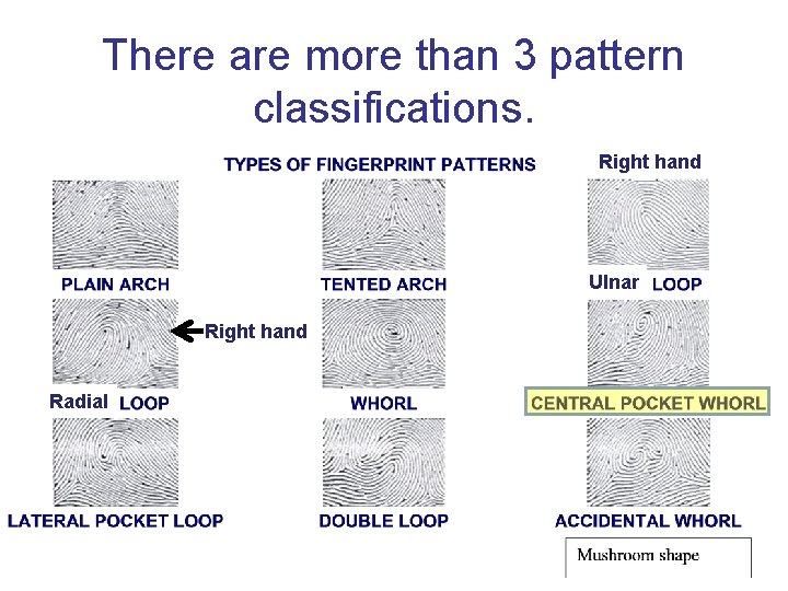 There are more than 3 pattern classifications. Right hand Ulnar Right hand Radial 