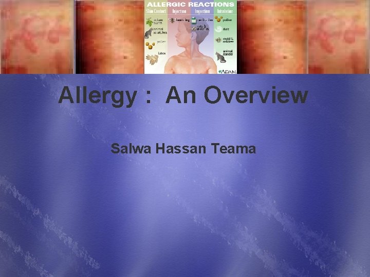  Allergy : An Overview Salwa Hassan Teama 