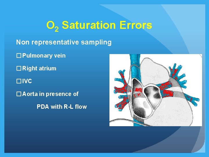 O 2 Saturation Errors Non representative sampling � Pulmonary vein � Right atrium � O 2 Saturation Errors Non representative sampling � Pulmonary vein � Right atrium �
