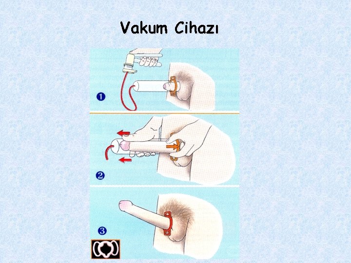 Vakum Cihazı 