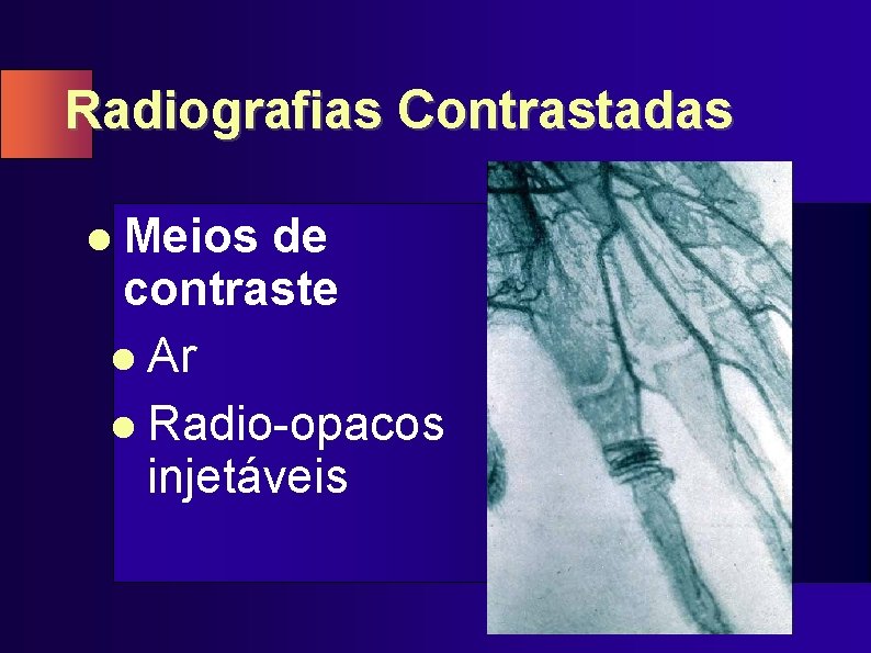 Radiografias Contrastadas l Meios de contraste l Ar l Radio-opacos injetáveis 