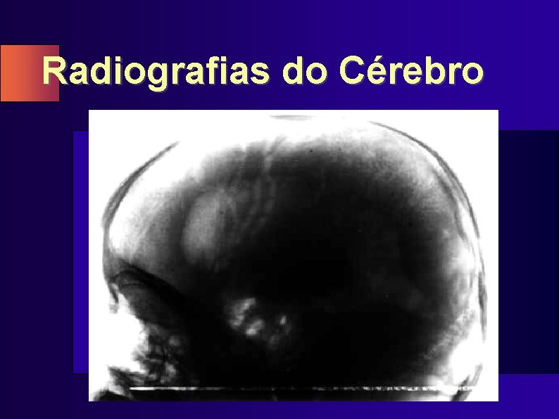 Radiografias do Cérebro 