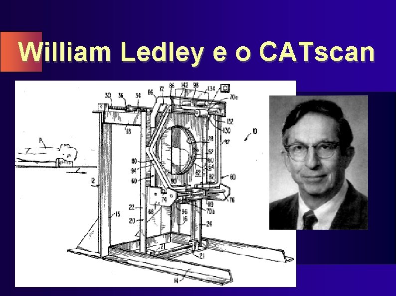 William Ledley e o CATscan 