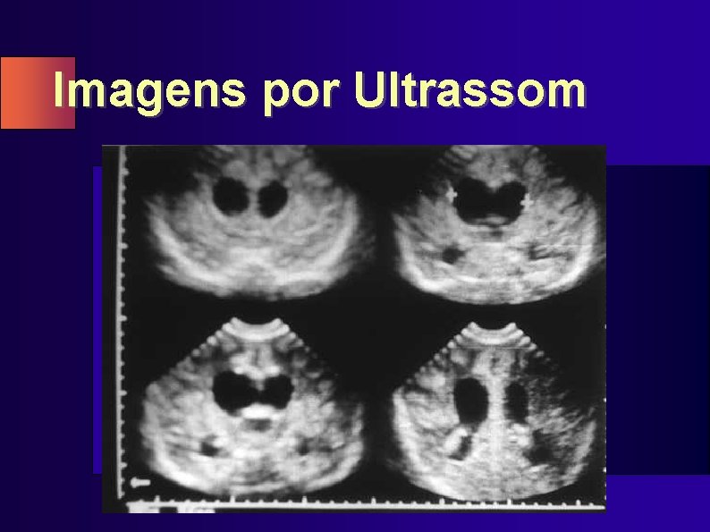 Imagens por Ultrassom 